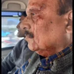 उत्तराखंड का शिक्षा विभाग मुख्यालय बना लड़ाई का अखाडा, प्रारंभिक शिक्षा निदेशक के सिर मे मारी कुर्सी, अजय नौटियाल को घायल अवस्था मे भेजा गया अस्पताल,घटना के बाद कर्मचारियो मे दिखा रोष, देखे घटना का लाइव वीडियो !