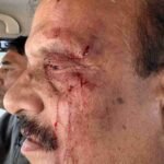 प्रारंभिक शिक्षा निदेशक से मारपीट, बीजेपी विधायक उमेश शर्मा काऊ के समर्थकों पर लगा आरोप, सियासत गरमाई